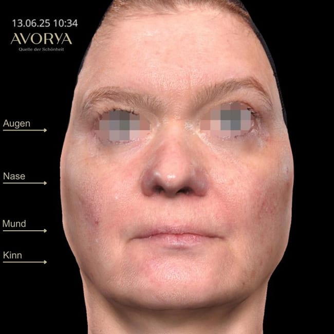 Praxis AVORYA gallery image 3