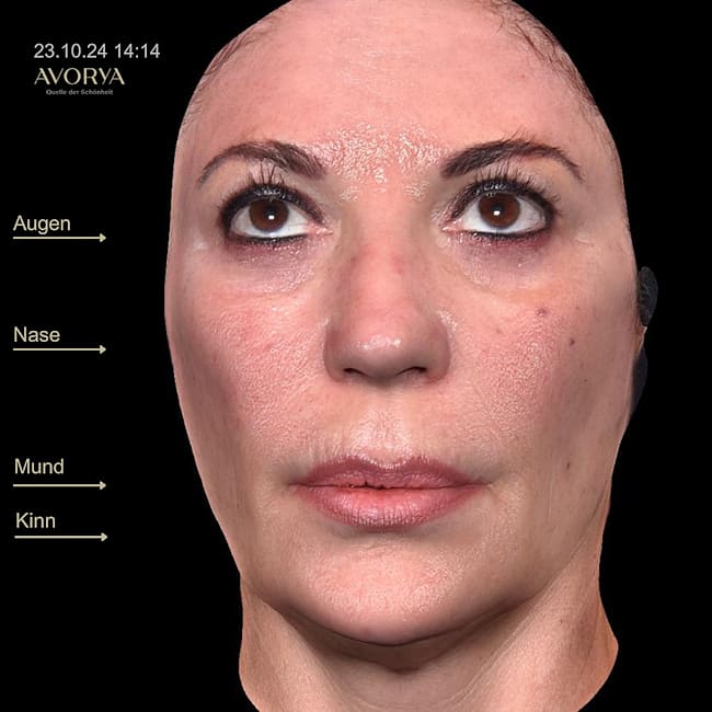 Praxis AVORYA gallery image 4