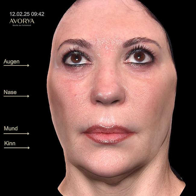 Praxis AVORYA gallery image 5