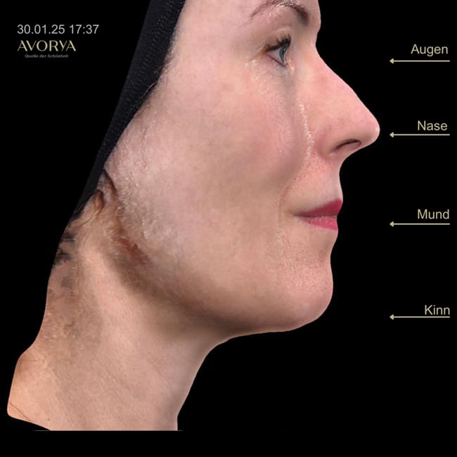 Praxis AVORYA gallery image 6