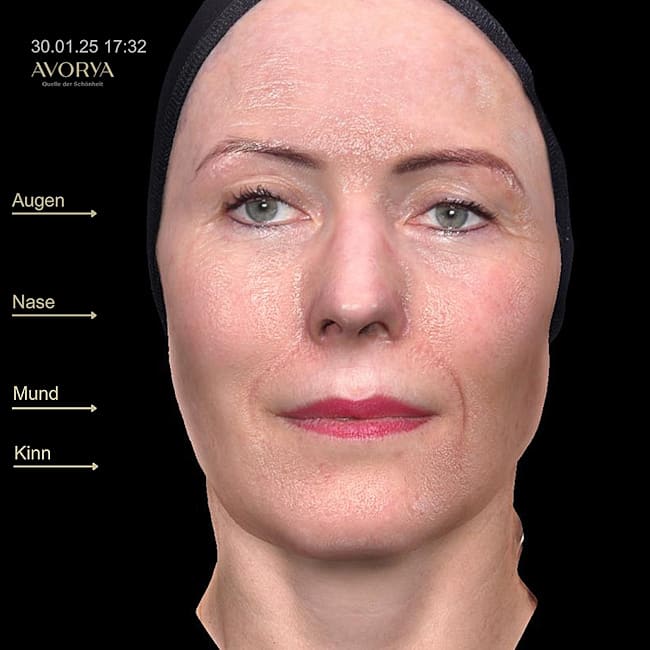 Praxis AVORYA gallery image 8