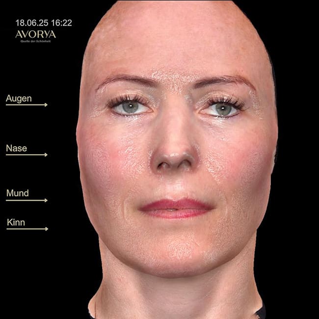 Praxis AVORYA gallery image 9