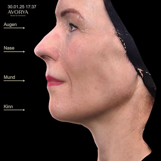 Praxis AVORYA gallery image 10