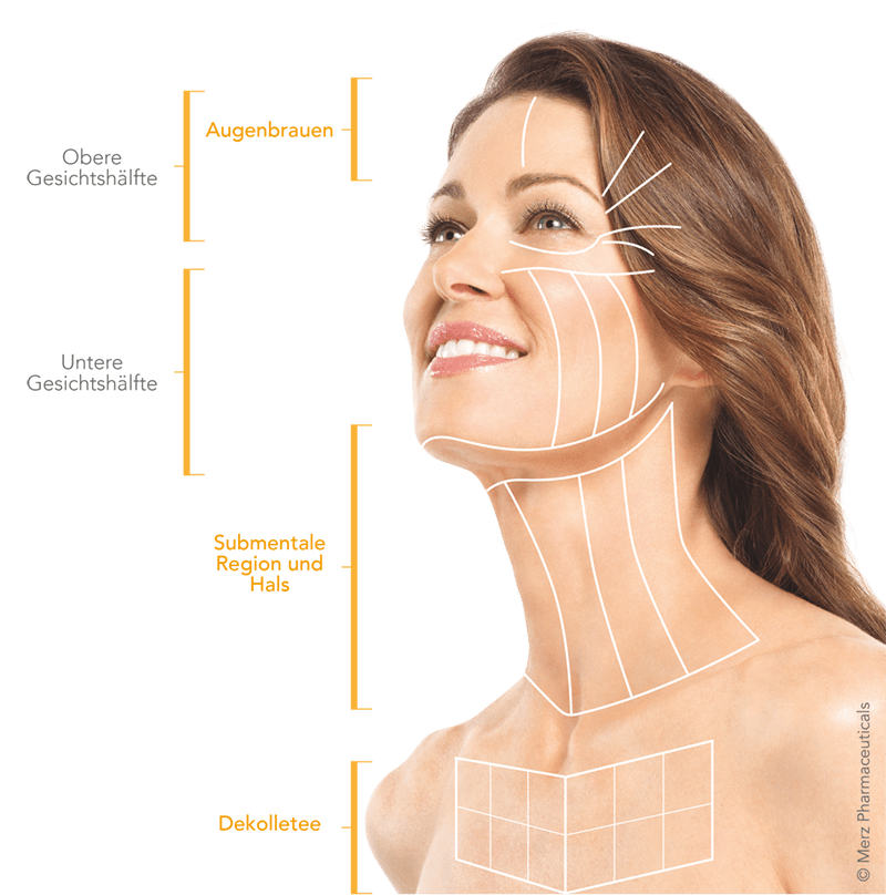 Ultherapy Basel | Hautstraffung für Gesicht, Hals und Dekolleté gallery image 4