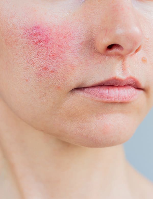 Derma Medical Clinic | Hautarzt, Venen und Ästhetik gallery image 4