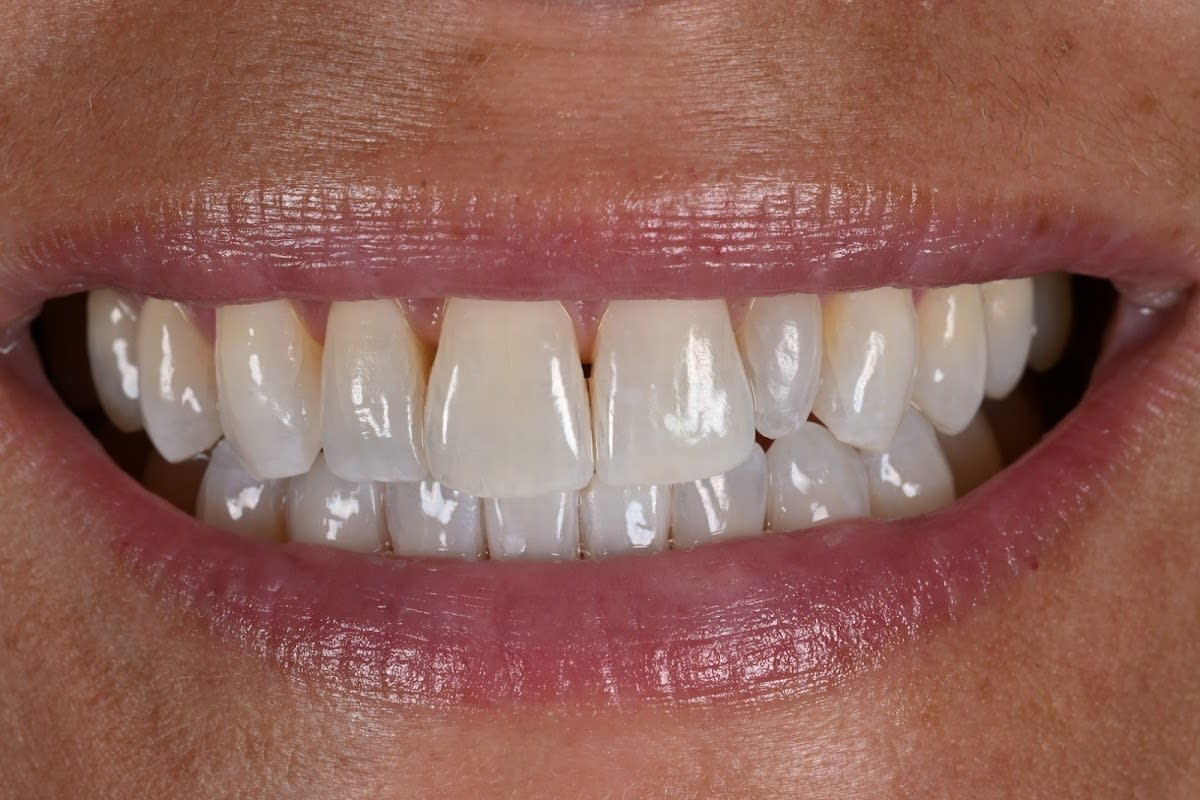 Cabinet d'hygiène dentaire Carolina Traviglia gallery image 4