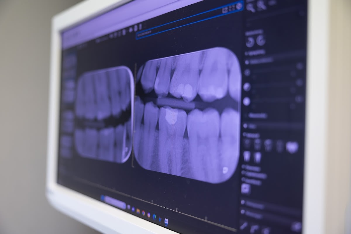 Zahnarztpraxis Horwdent gallery image 6