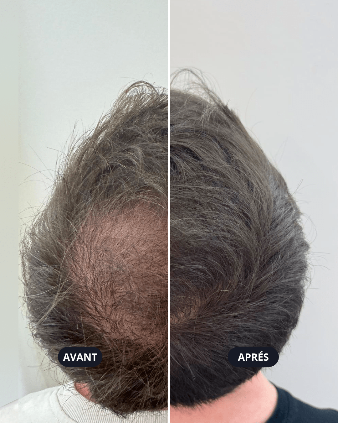 Clinique Hairsss gallery image 9