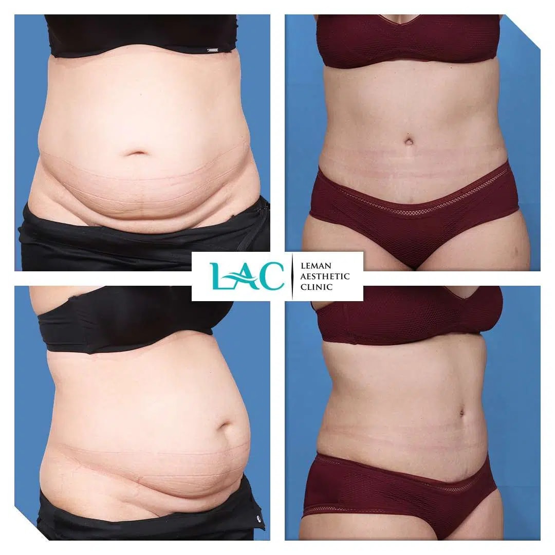 Leman Aesthetic Clinic gallery image 4