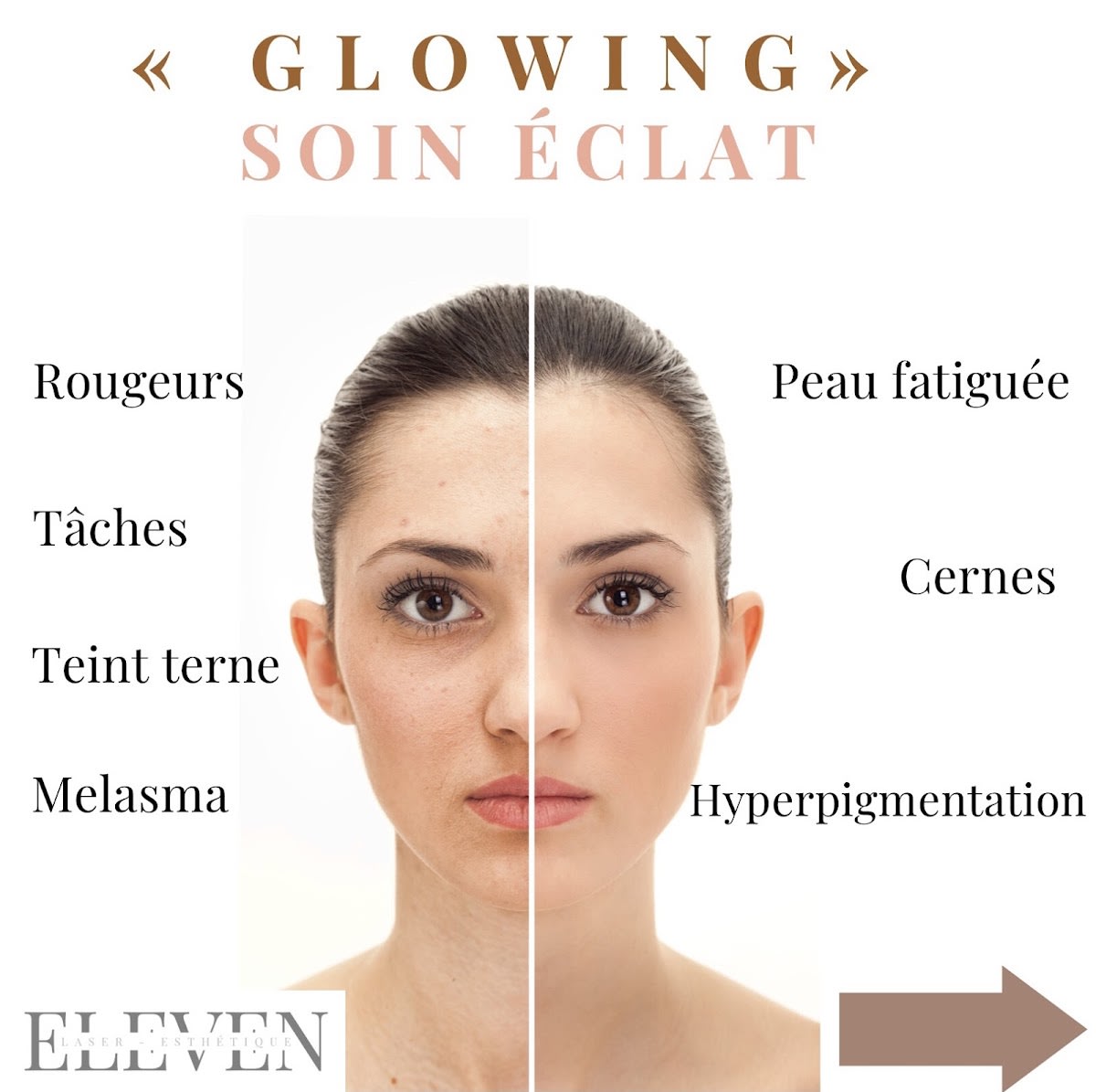 Eleven Institut & Formation gallery image 10