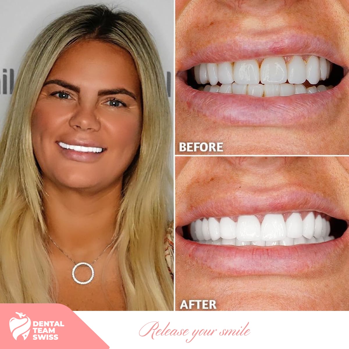 Dental Team Swiss gallery image 10