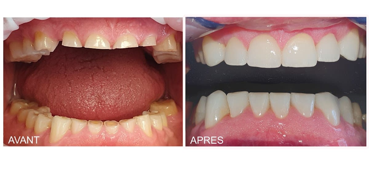 Cabinet Dentaire du Casino gallery image 6