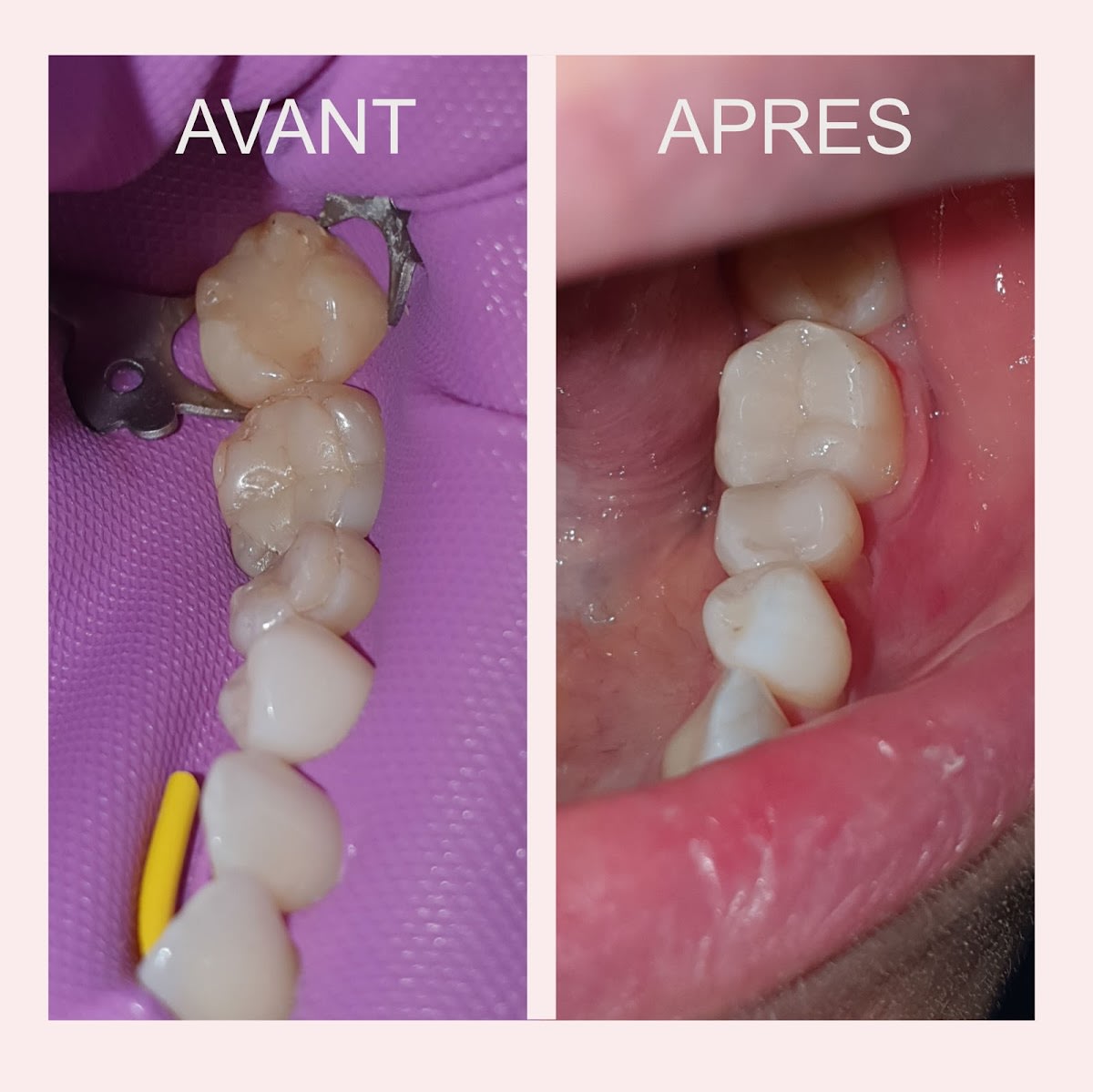 Cabinet Dentaire du Casino gallery image 7