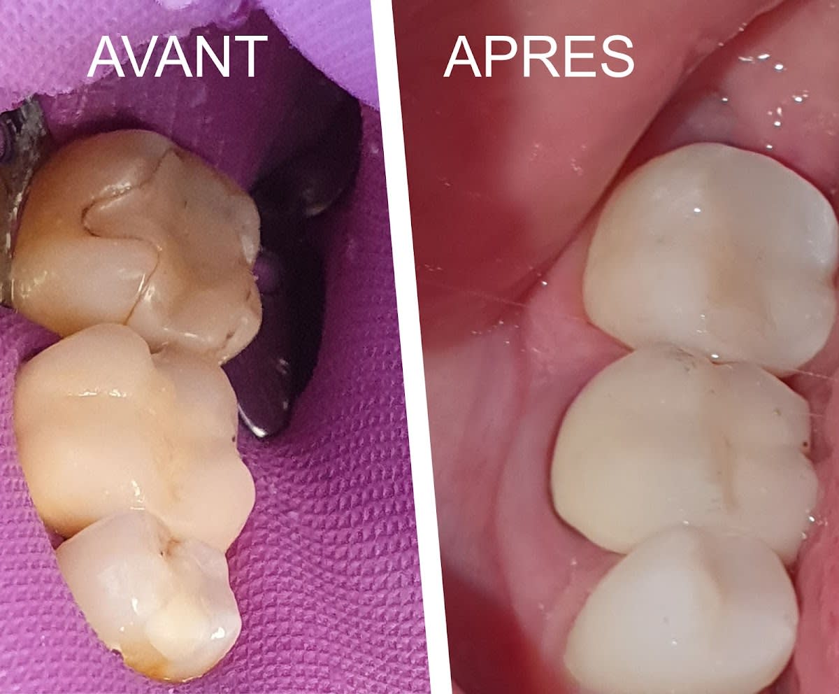 Cabinet Dentaire du Casino gallery image 8