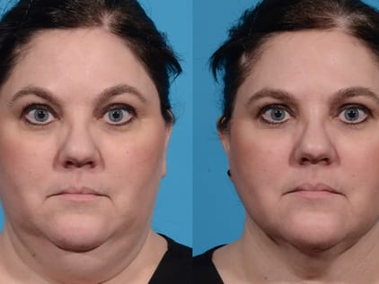 cosmedic-luzern gallery image 6