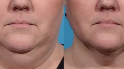 cosmedic-luzern gallery image 7