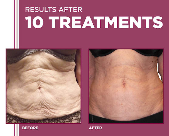 Orchimed Medizinisch-kosmetisches Institut Bern - Sanfte Ästhetik für Hautstraffung, Fettreduktion & Cellulité ohne OP gallery image 3