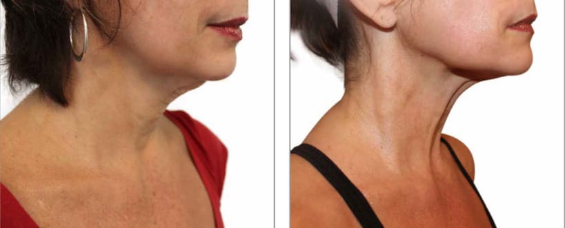 Orchimed Medizinisch-kosmetisches Institut Bern - Sanfte Ästhetik für Hautstraffung, Fettreduktion & Cellulité ohne OP gallery image 10