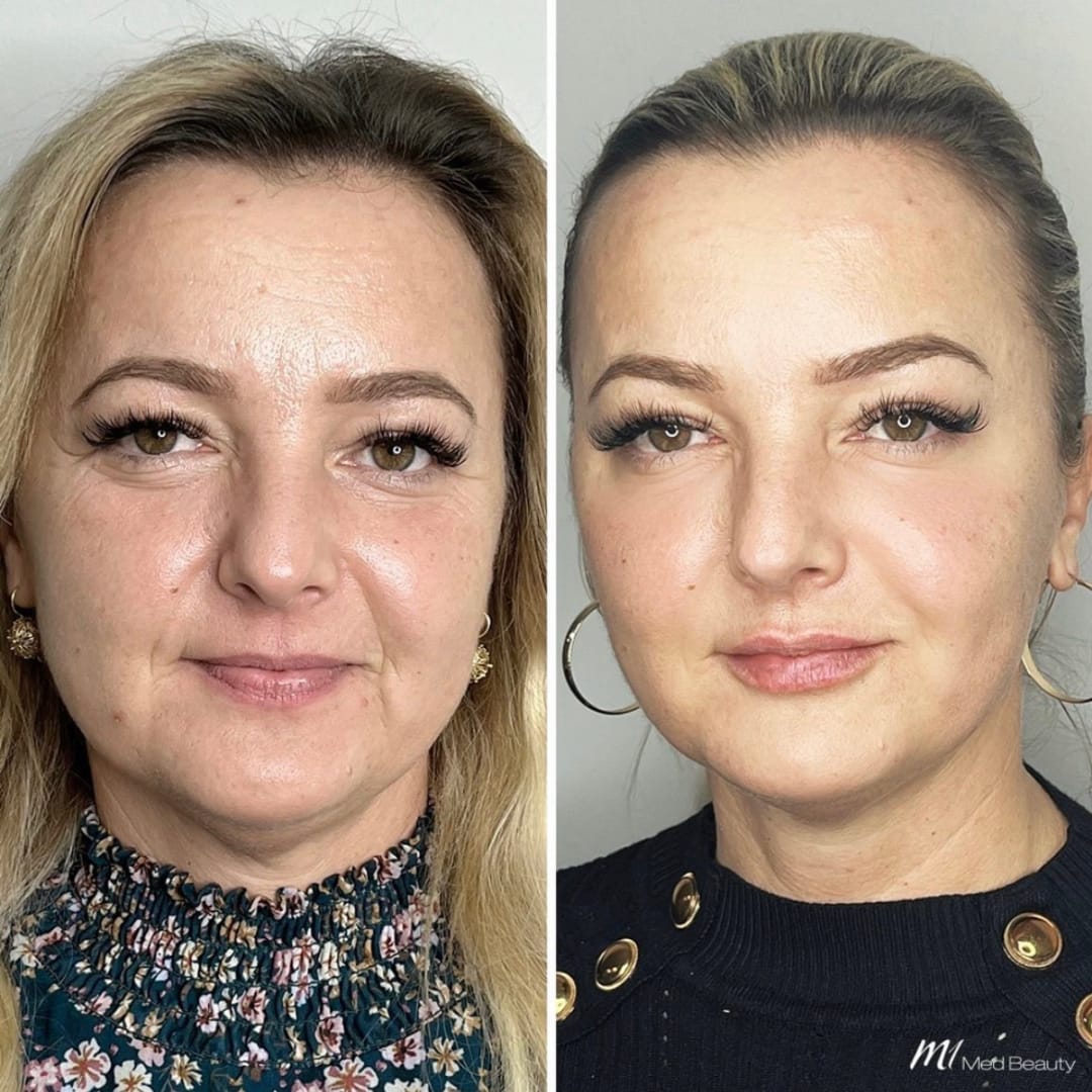 M1 Med Beauty Zürich gallery image 6