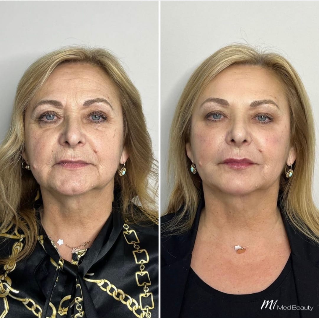 M1 Med Beauty Zürich gallery image 7