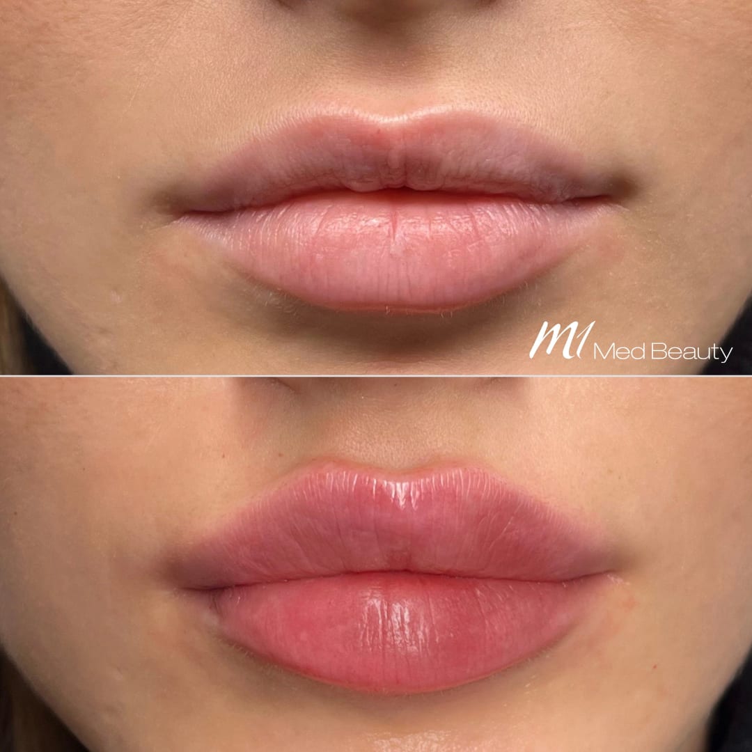 M1 Med Beauty Zürich gallery image 8