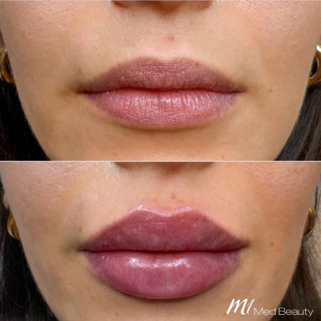 M1 Med Beauty Zürich gallery image 9