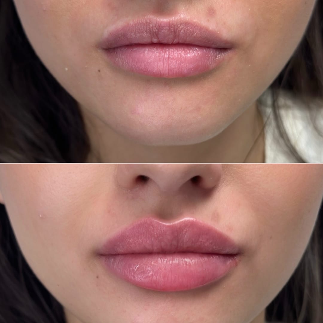 M1 Med Beauty Zürich gallery image 10