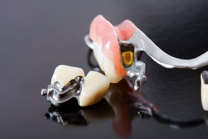 Dentaltechnik Henze gallery image 7