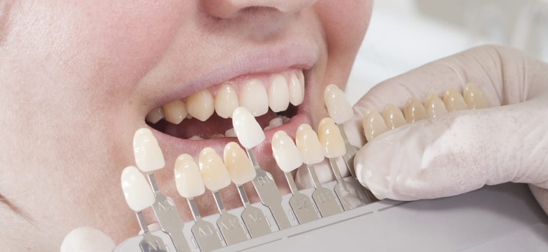 Dentaltechnik Henze gallery image 8