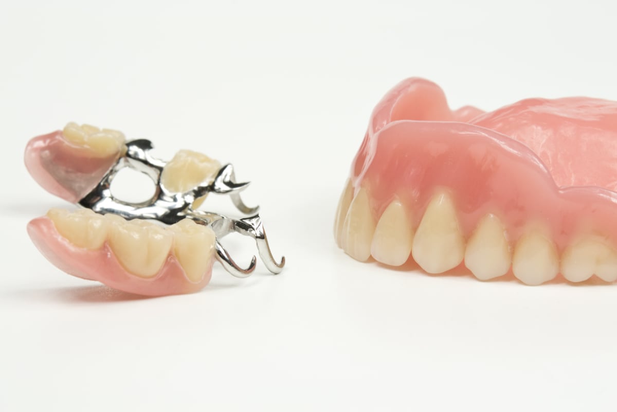 Dentaltechnik Henze gallery image 10