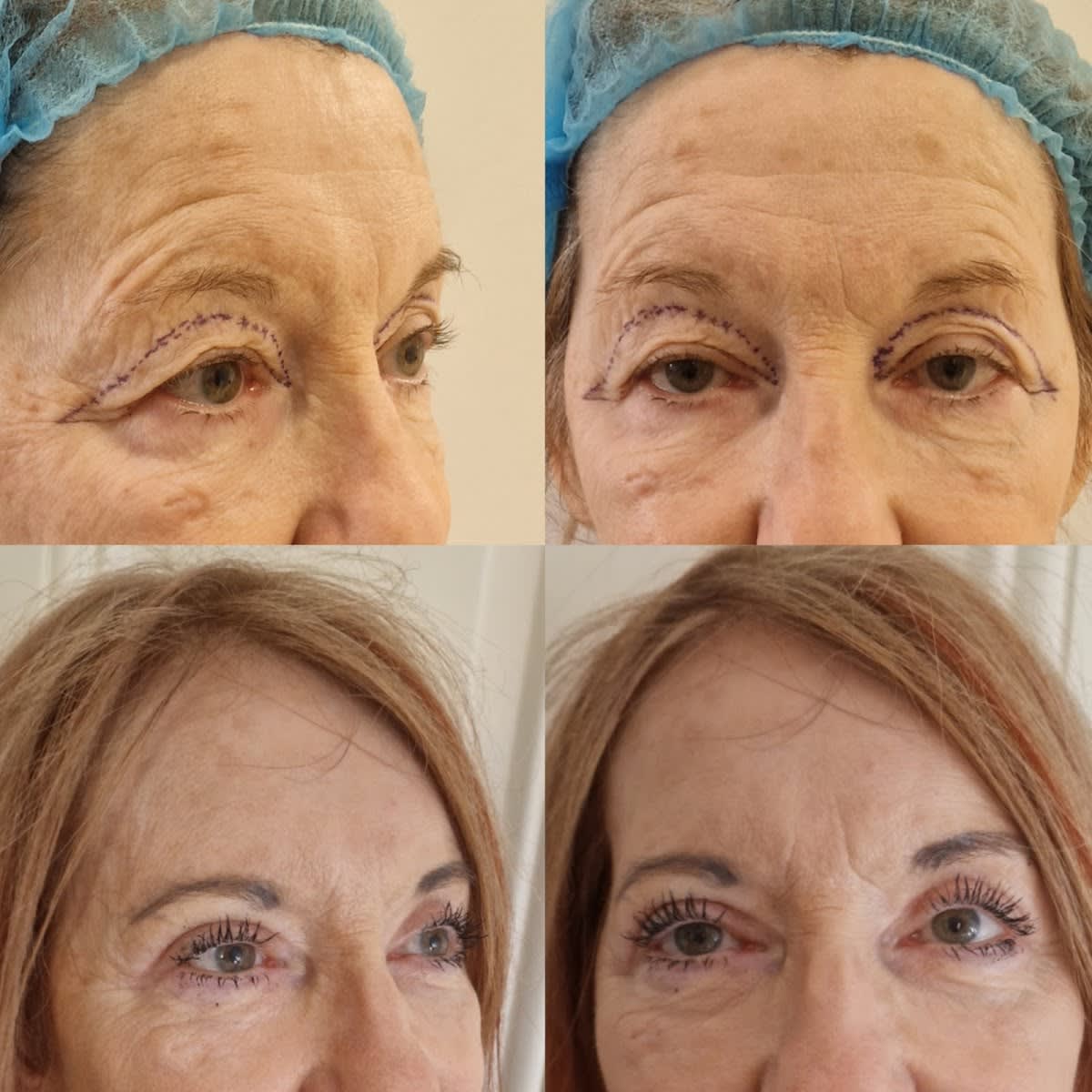 Dr Lucas Plastic Surgery gallery image 4