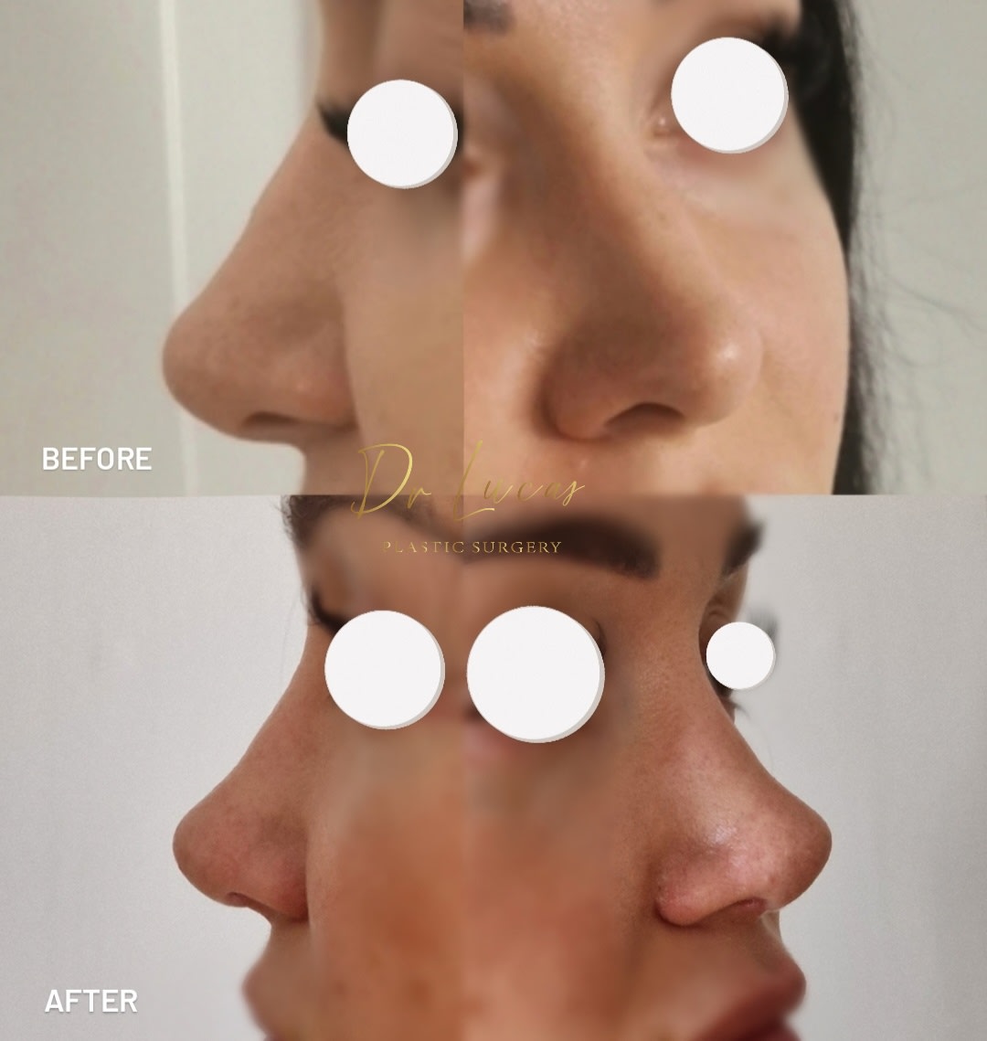 Dr Lucas Plastic Surgery gallery image 5