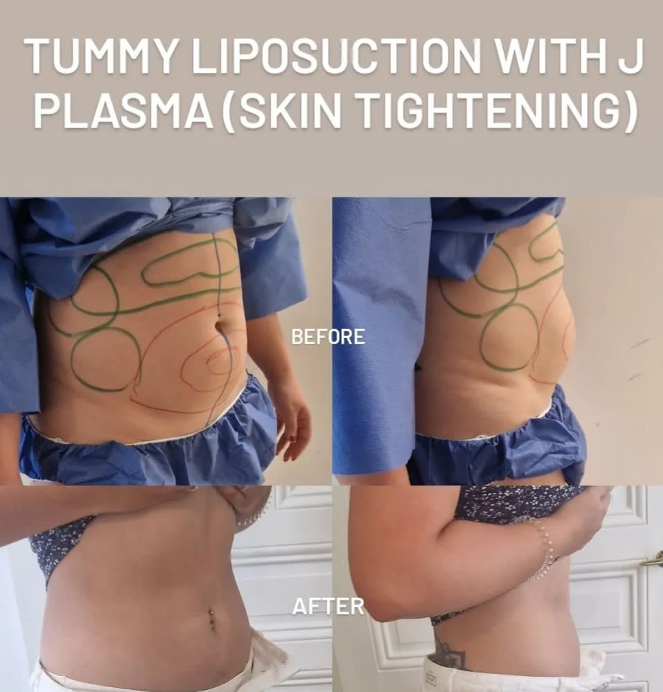 Dr Lucas Plastic Surgery gallery image 6