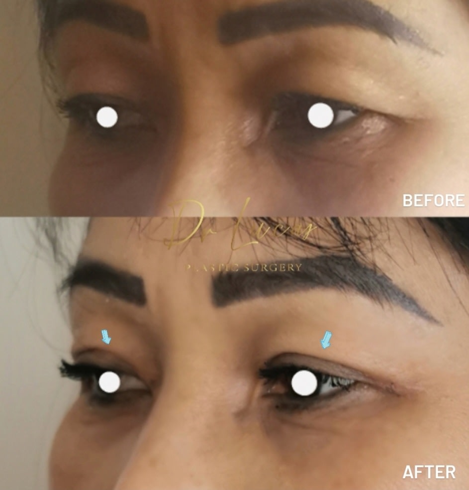 Dr Lucas Plastic Surgery gallery image 8