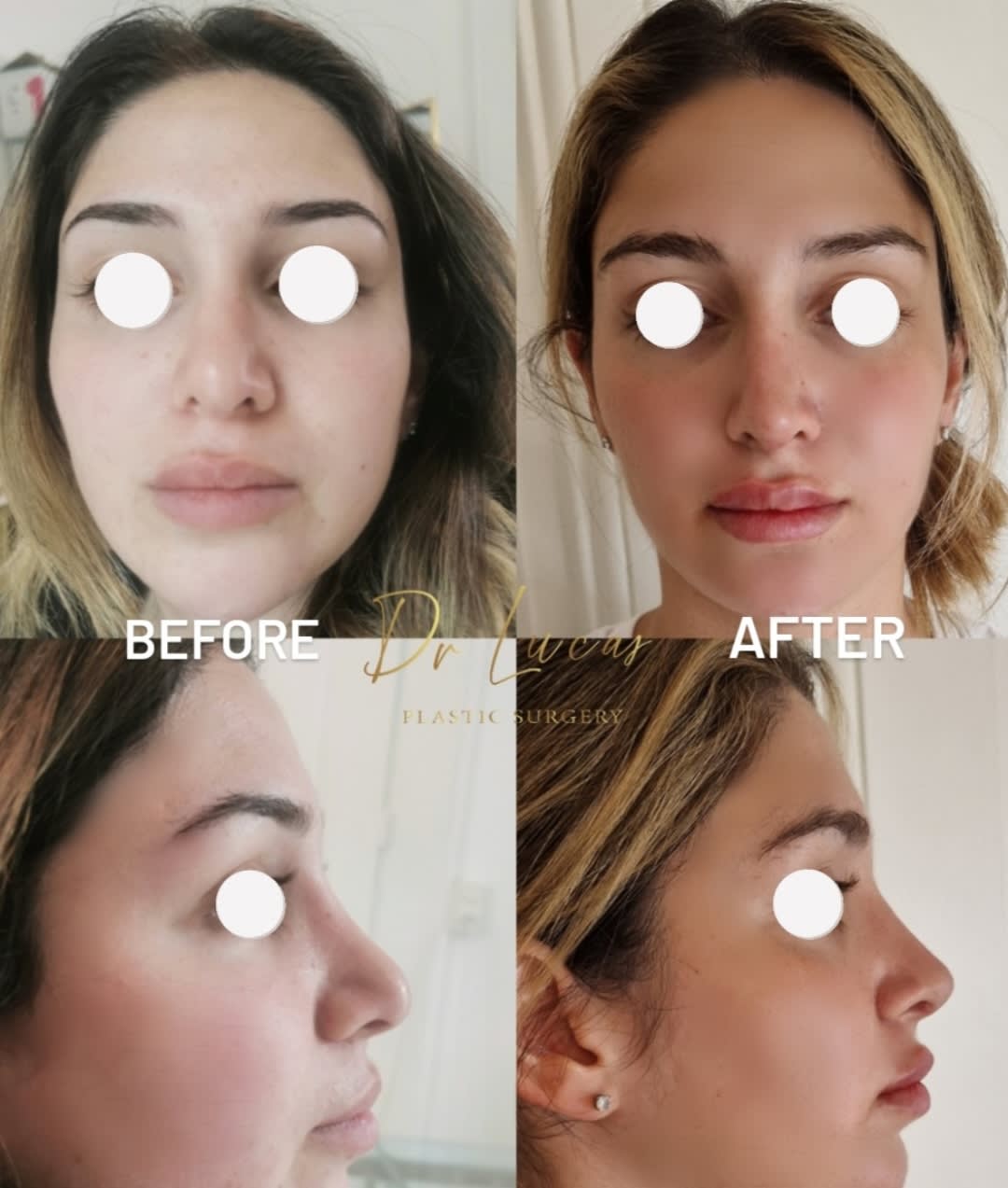 Dr Lucas Plastic Surgery gallery image 9