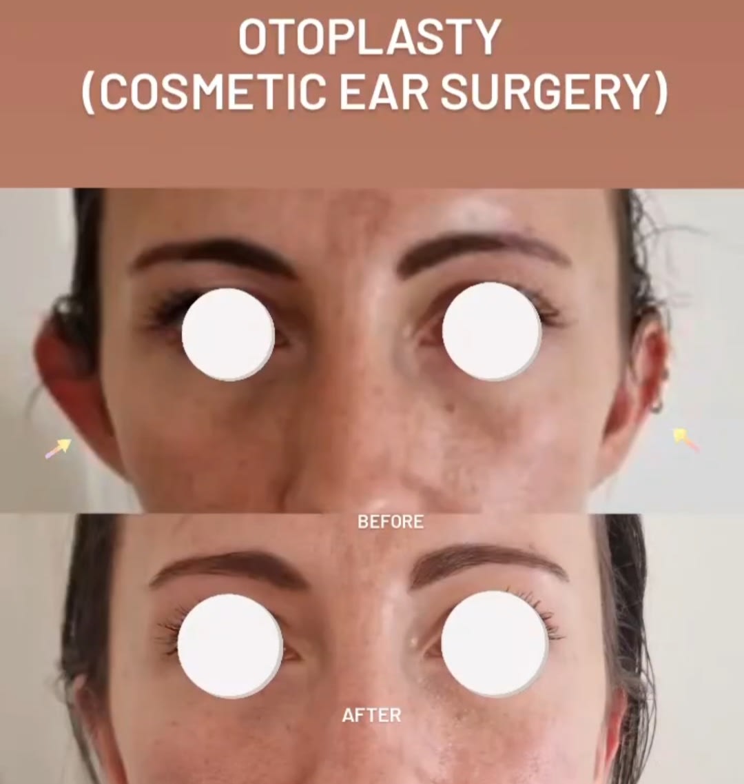 Dr Lucas Plastic Surgery gallery image 10