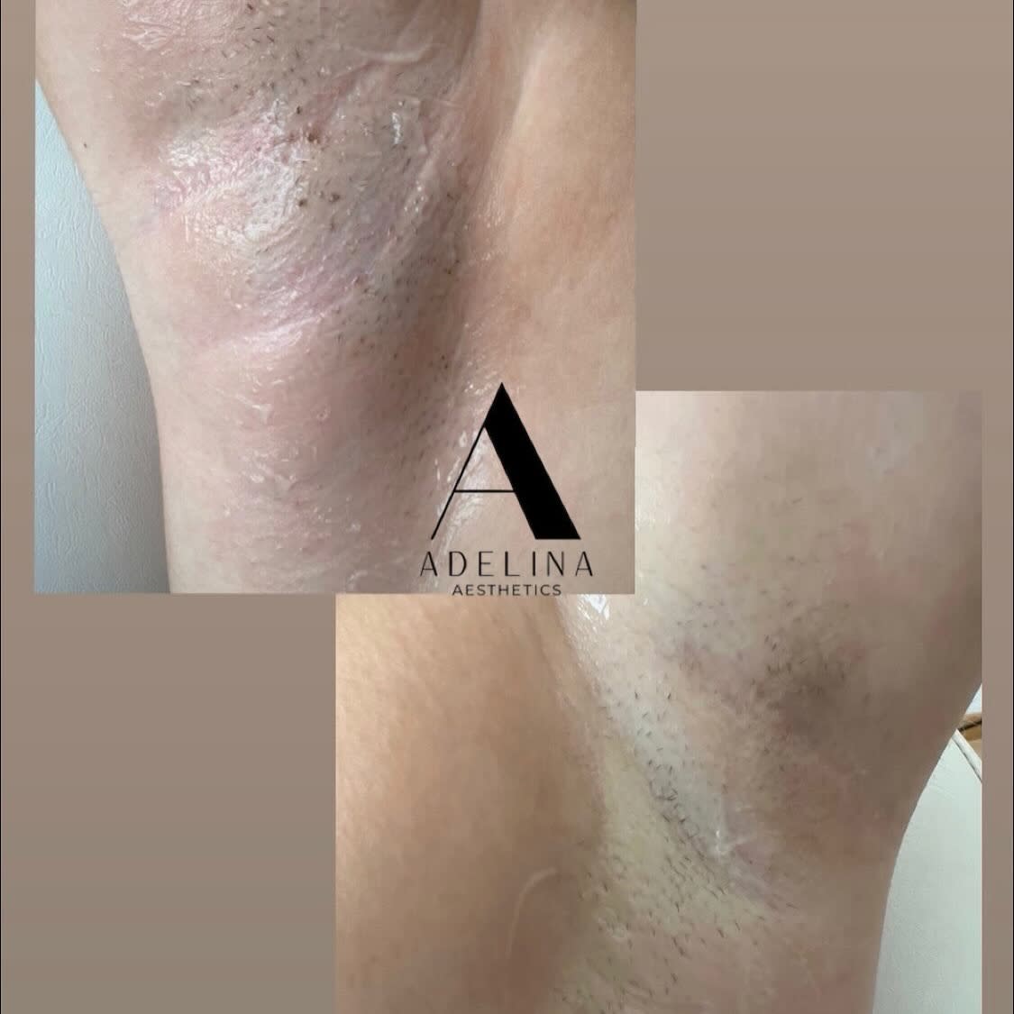 Adelina Aesthetics gallery image 9