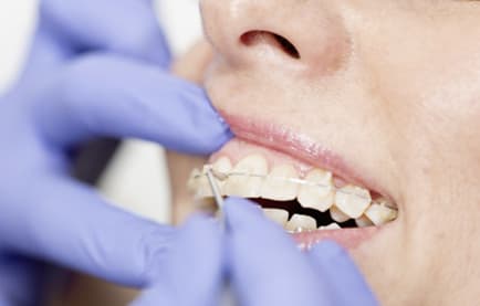 Helvident Centre Dentaire Fribourg SA gallery image 1