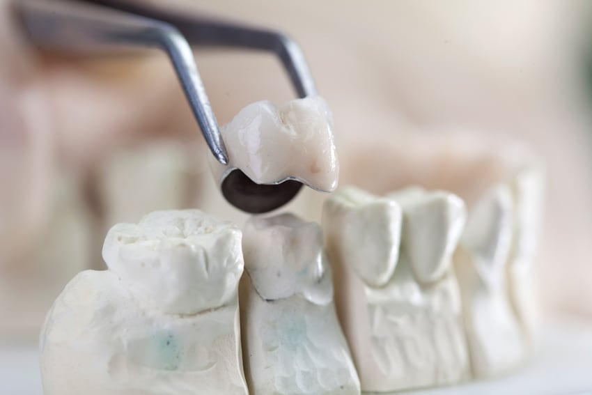 Zahnarzt Luzern Zahnarztpraxis Dr. med. dent. Martin Stahl - I & ZZ AG gallery image 4