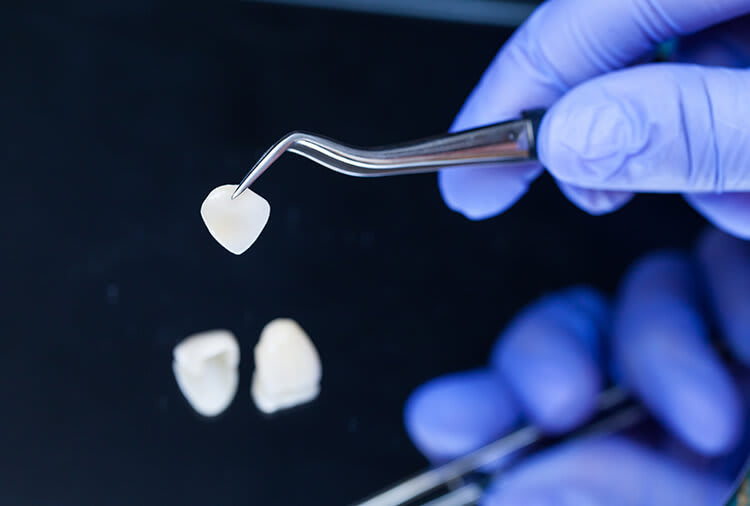 Zahnarzt Luzern Zahnarztpraxis Dr. med. dent. Martin Stahl - I & ZZ AG gallery image 6