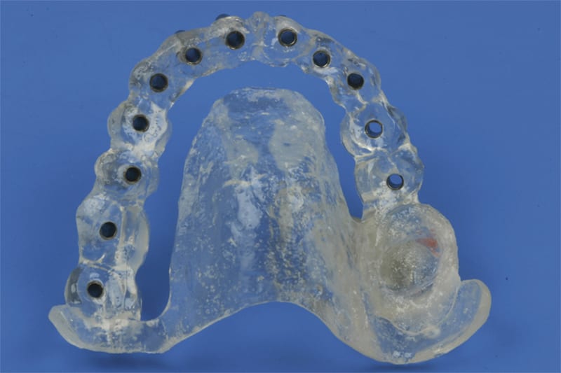 Zahnarzt Luzern Zahnarztpraxis Dr. med. dent. Martin Stahl - I & ZZ AG gallery image 8