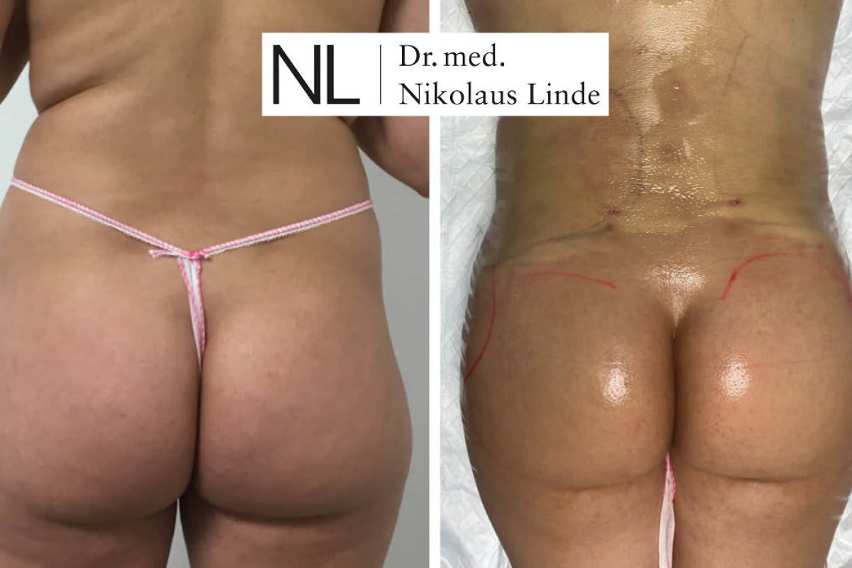 LIPOCLINIC Zürich gallery image 1