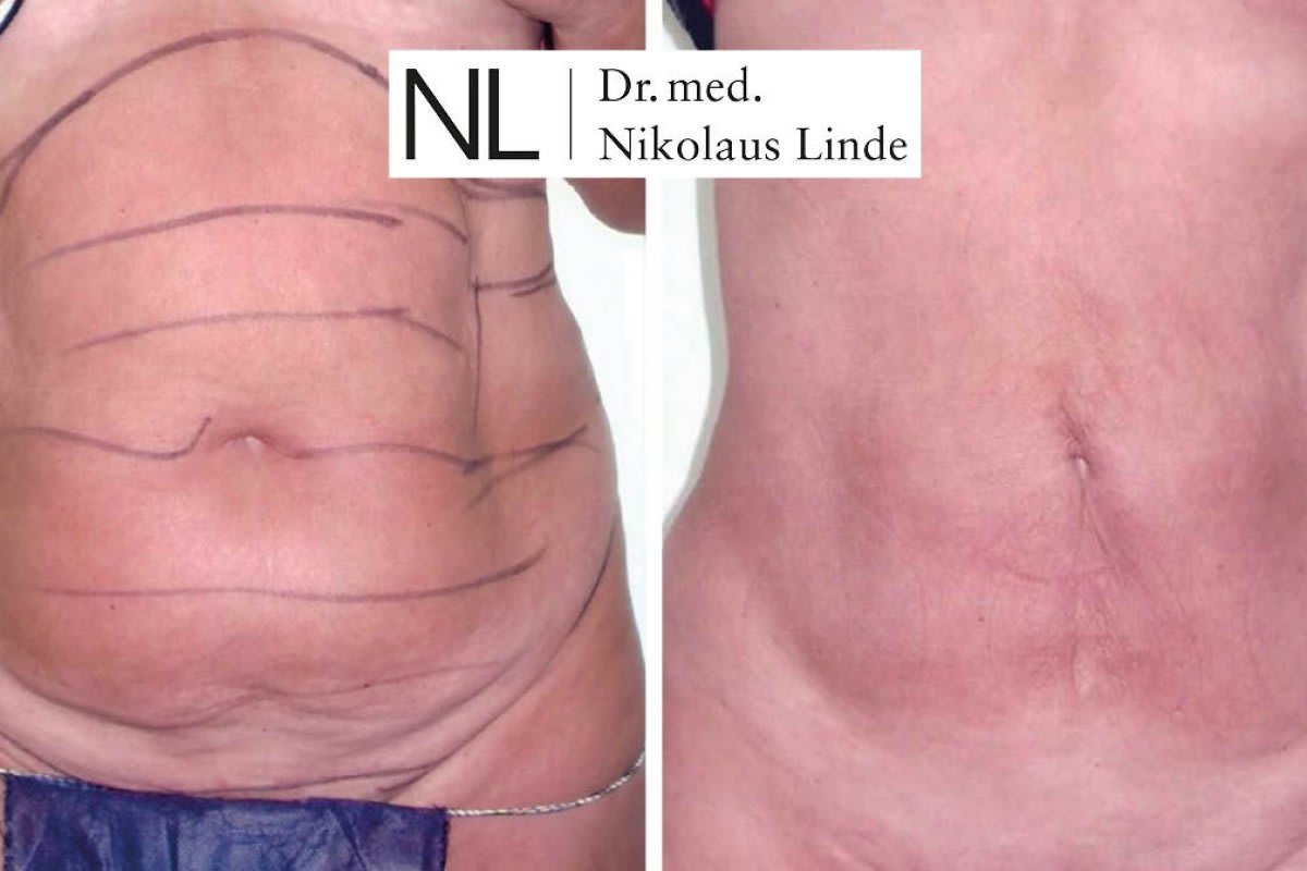 LIPOCLINIC Zürich gallery image 3