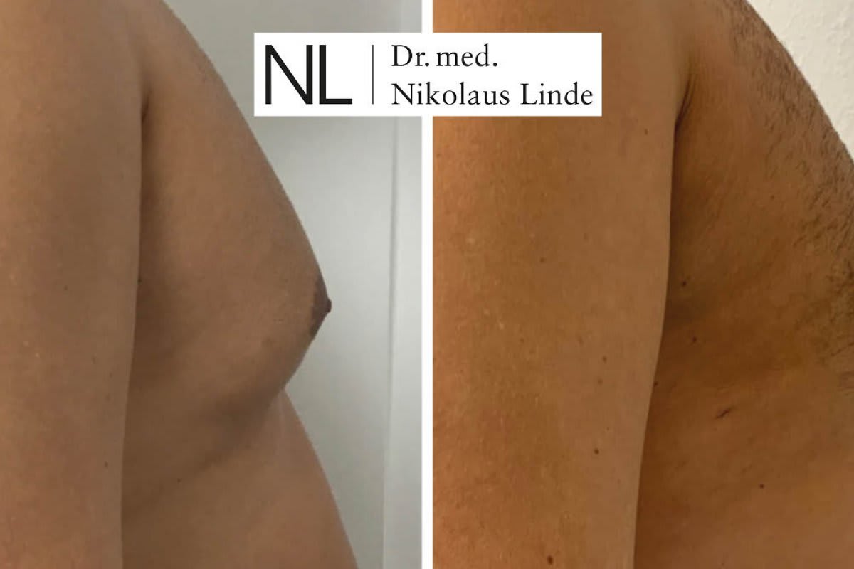 LIPOCLINIC Zürich gallery image 4