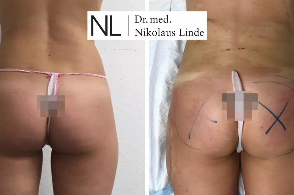 LIPOCLINIC Zürich gallery image 10