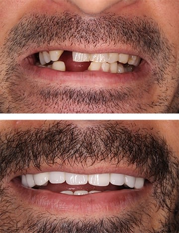 Centrocc Dental GmbH – Zahnbehandlung Ungarn gallery image 8