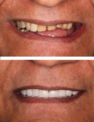 Centrocc Dental GmbH – Zahnbehandlung Ungarn gallery image 9