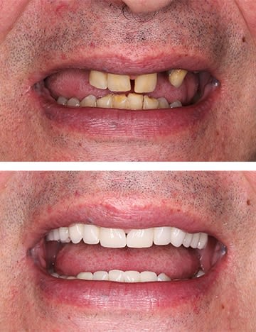 Centrocc Dental GmbH – Zahnbehandlung Ungarn gallery image 10