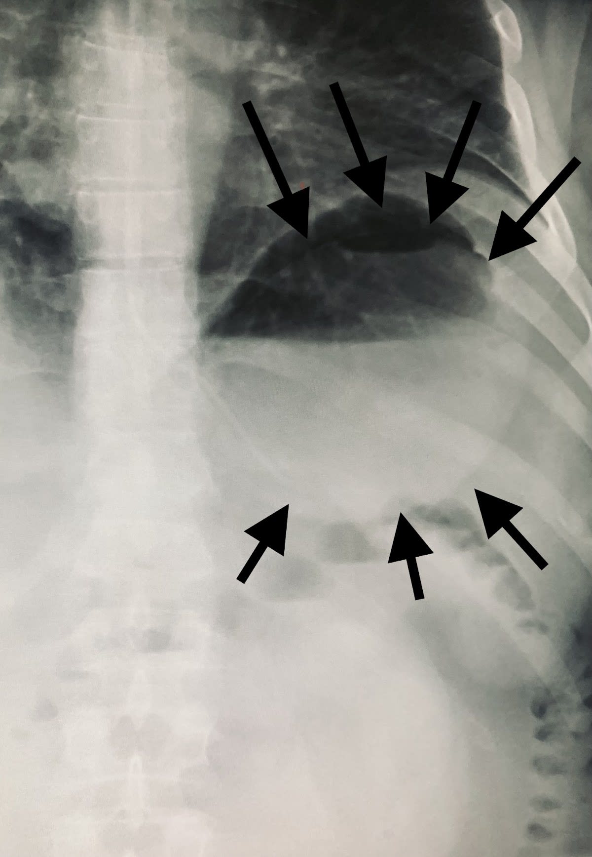 Allurion Balloon Geneva gallery image 5