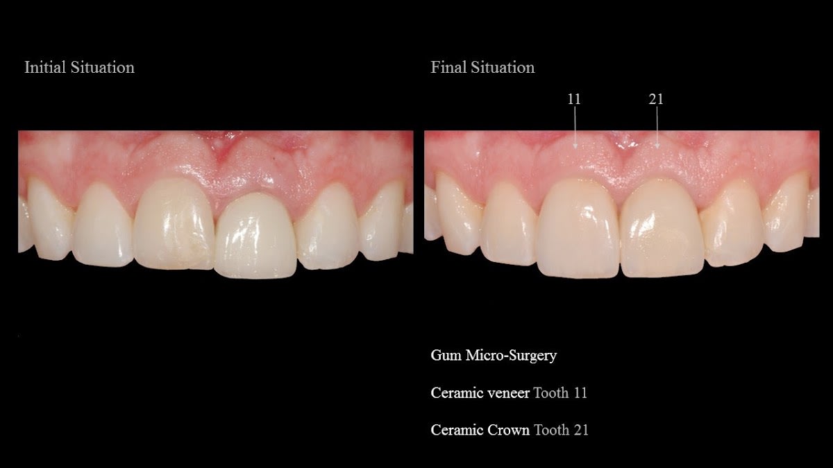 Helvetic Dental Center - Dr Nacer Benbachir - Dr Malika Meyer gallery image 7